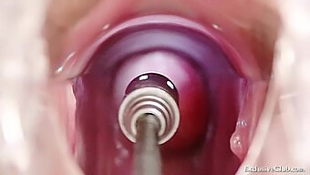 Intense Medical Examination Of A Blonde Babe'S Intimate Areas Including Enema